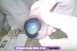 Dissecação do Olho Bovino